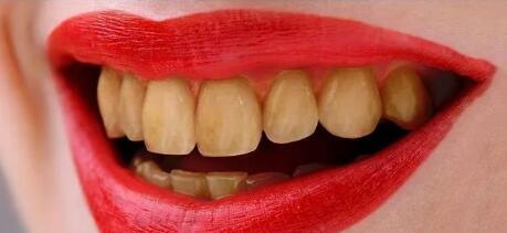 补牙的牙套有个裂痕能补吗