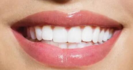 牙齿不齐可以美白牙齿吗(牙齿不齐可以做美白牙齿吗)