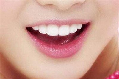 美容冠牙齿矫正的原理