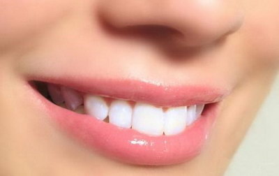 根管治疗一颗牙齿需要套几个牙冠