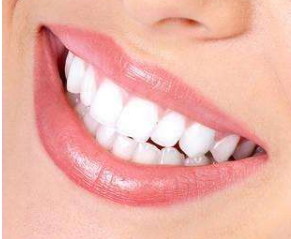 牙套是如何让牙齿移动_取牙套后多久牙齿不晃