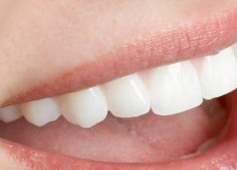 单颗活动假牙是怎么固定的