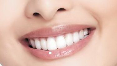 做牙齿美白有什么副作用_冷光牙齿美白仪有副作用吗