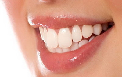 隐形牙套靠什么拉动牙齿_隐形牙套戴着牙齿酸正常吗