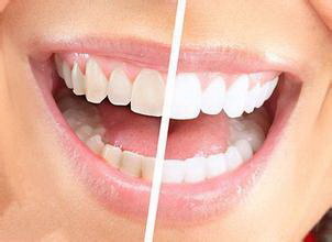 拔牙第二天刷牙后伤口有血_拔牙后多长时间能刷牙漱口