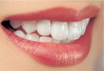 牙龈退缩能恢复吗