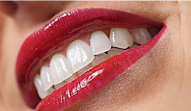 拔牙一个月了牙洞还很大很深_拔牙一个月了牙洞还是红色的