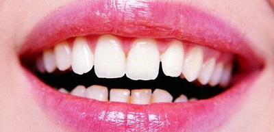 儿童牙龈外面长了一个牙齿_儿童牙龈上长个小牙齿图片