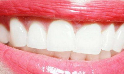 做完根管治疗后必须带牙套吗_做完根管治疗一定要带牙套吗
