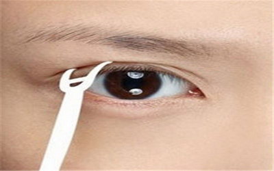 先天性右眼睑下垂能治好吗