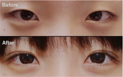 黑眼圈严重是身体上什么原因引起的(长期黑眼圈严重是身体上什么原因引起的)