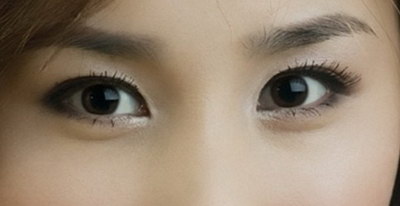 做完双眼皮眼角有皱纹是什么情况_割完双眼皮一个月右眼角往下垂的女孩应该怎么治疗