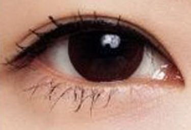 黑眼圈长期存在是什么原因造成的