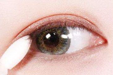 黑眼圈特别严重什么原因_黑眼圈长期存在怎么回事