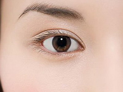 双眼皮筋膜修复术是什么