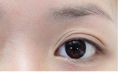 彩光治疗黑眼圈_如何快速治疗黑眼圈和眼袋