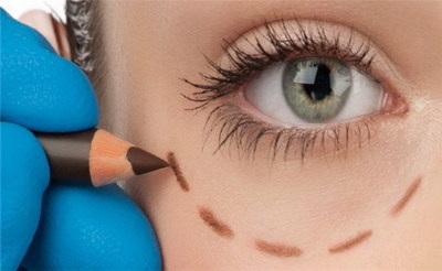 先天性眼睑下垂怎样治疗