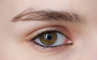 割双眼皮大概多久能完全恢复_割双眼皮大概多久能正常工作