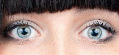割双眼皮多长时间能恢复_割双眼皮多长时间能修复