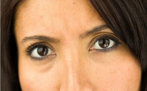 双眼皮恢复期出现三眼皮_割完十年双眼皮变三眼皮