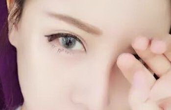 双眼皮肿成单眼皮了怎么办_割了双眼皮能恢复单眼皮吗