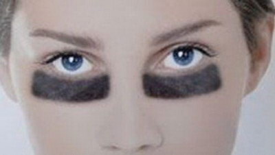 眼角皮瓣手术后的效果:让眼睛显得更有神采_眼角是哪条经络循行