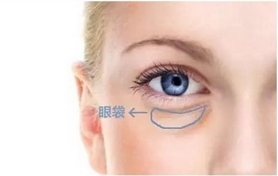 北京做双眼皮手术最好口碑医生_过年能做双眼皮手术吗