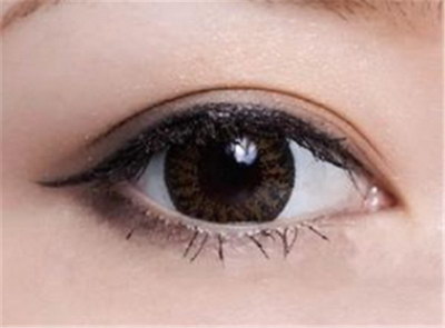 割双眼皮要多久可以恢复正常_割双眼皮一般要多久能做修复