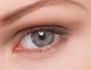 割双眼皮后有白色的线一样的皮_割双眼皮后有白色的小颗粒