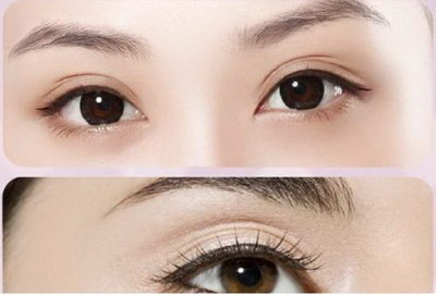 单眼皮和双眼皮哪个是真正的中国人