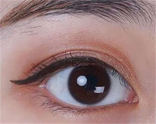 阿拉善右旗黑眼圈美容医美7强优质口碑医生专注技术提升