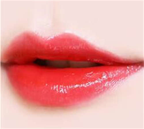 嘴型是天生畸形的那种怎么做口唇矫正术？