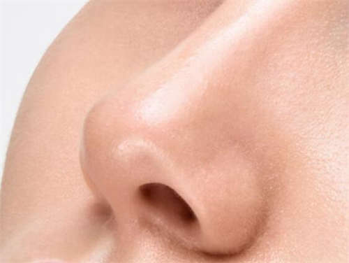 隆鼻后注意事项及护理是什么