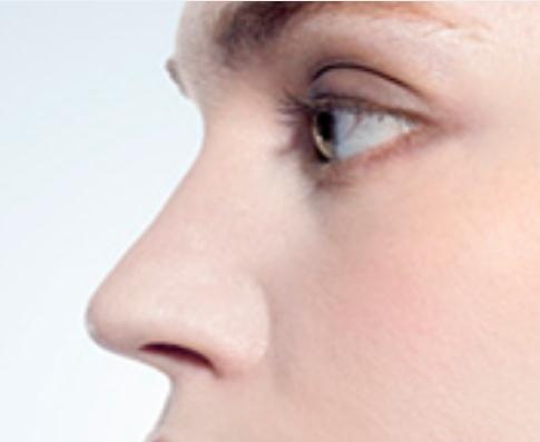 鼻小柱缺损修复：术前术后对比图片