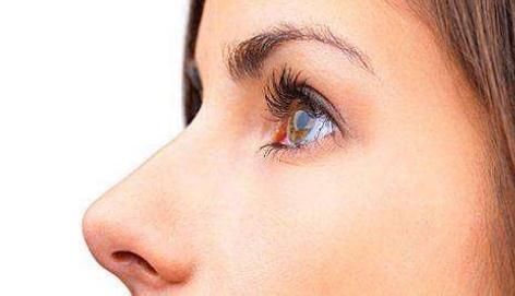 鼻综合多久能做鼻翼外切_鼻翼外切恢复十天对比图