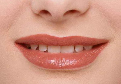 唇隐裂和唇裂哪个严重_单侧唇裂术后畸形常见