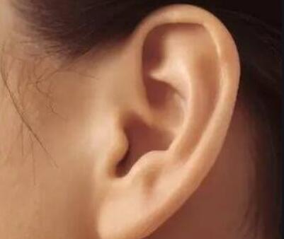 耳垂裂的最佳修复方法