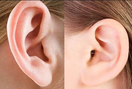 先天耳朵畸形怎么治疗_做耳朵手术需要全麻吗