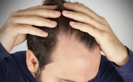 吃什么中药可以治疗脱发和生发_出月子后脱发是什么原因引起的