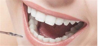 做牙套的塑料是什么材质_做的固定牙套能拿下来吗