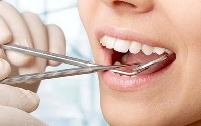 根管治疗过程中牙齿会松动吗