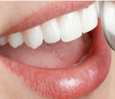 根管治疗后需要做牙套还是嵌体_根管治疗牙套国产和进口的区别