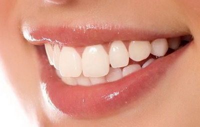 可复性牙髓炎能自愈吗_可复性牙髓炎吃什么药