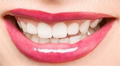 牙齿矫正可以把大门牙变小吗