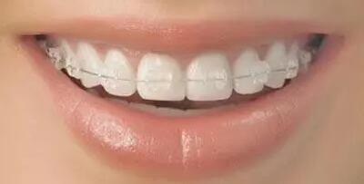 镶牙齿与种牙(现代修复牙齿的两种方式:镶牙与种牙)