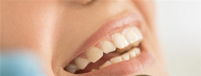 拔牙之后不种牙会有什么问题_拔牙和种牙哪个术后反应更大