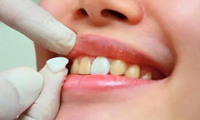 拔牙甲硝唑片是消炎药吗_拔牙假膜掉了之后有点痛