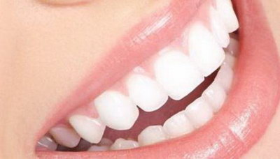 冷光美白牙齿可以保持多久