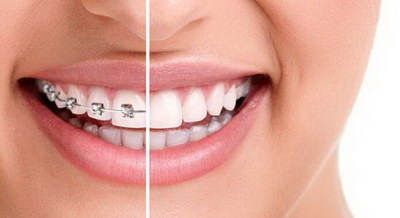 补牙后牙齿发酸是什么原因
