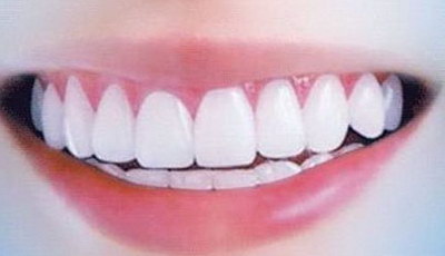 做过根管治疗的牙齿可以做矫正吗_做根管治疗旁边的牙会不会有影响